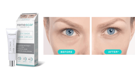 recensione remescar eye bags trattamento per borse e occhiaie scure